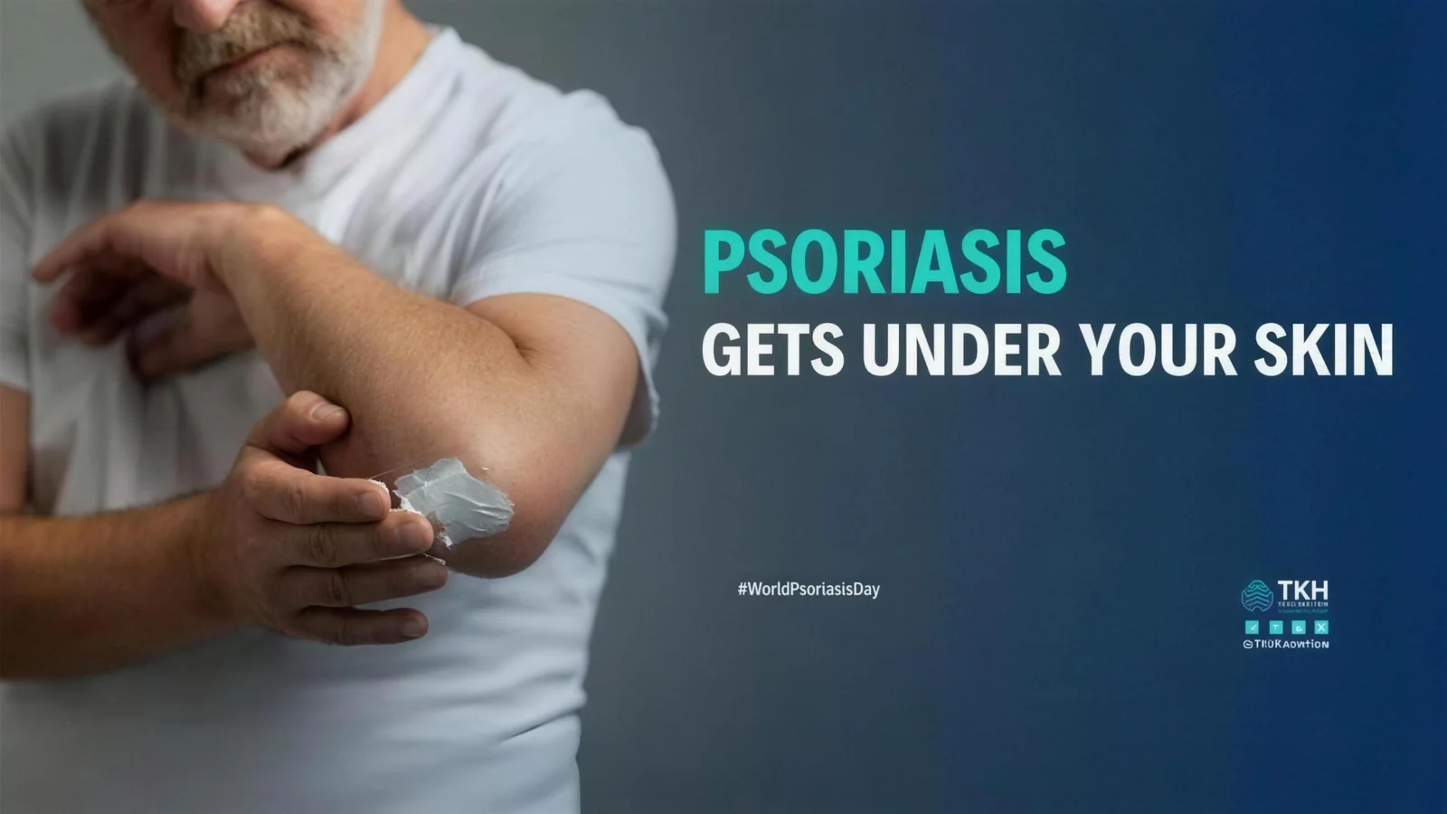 Psoriasis gets under your skin