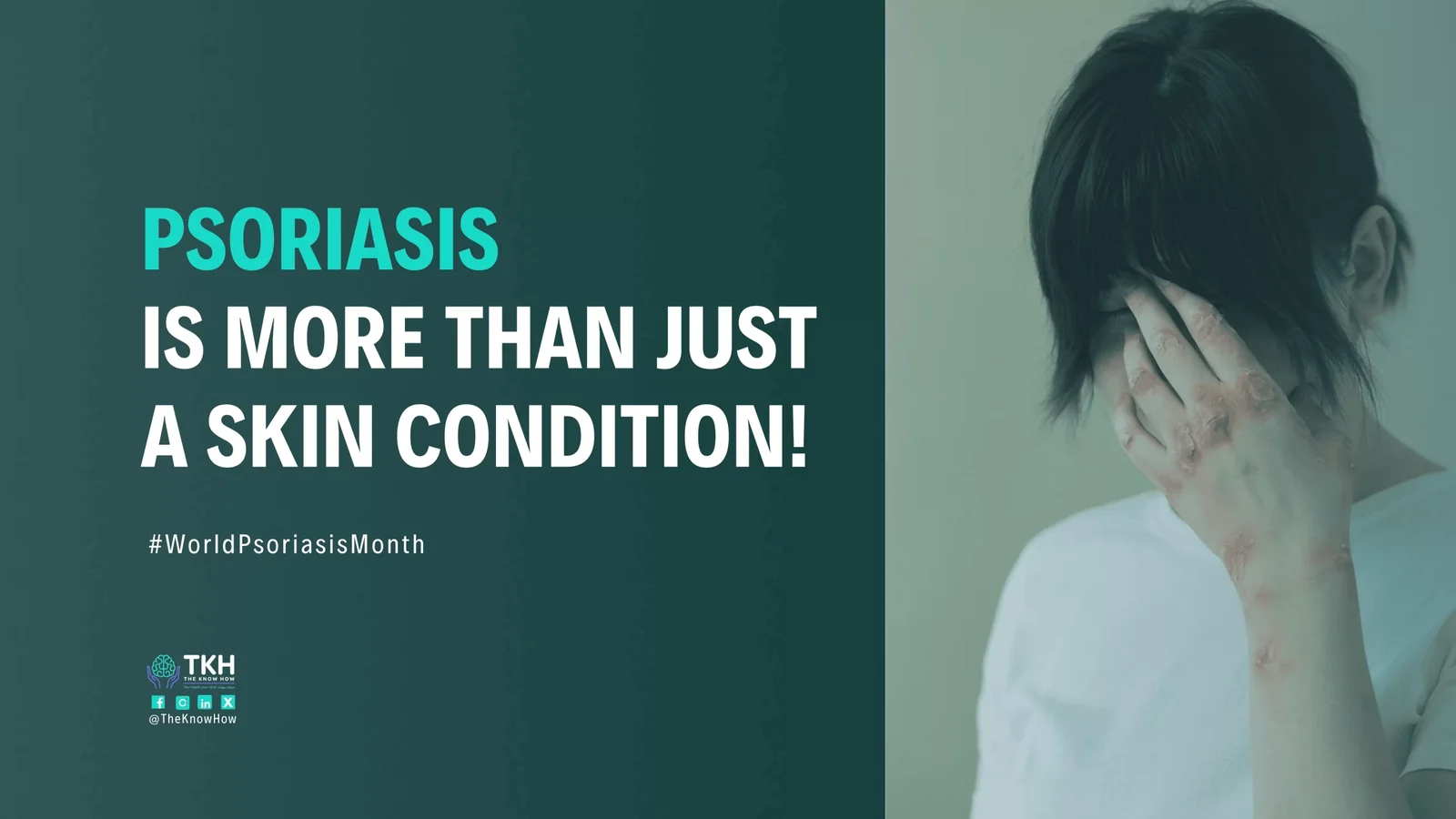 Psoriasis is more than just a skin condition!